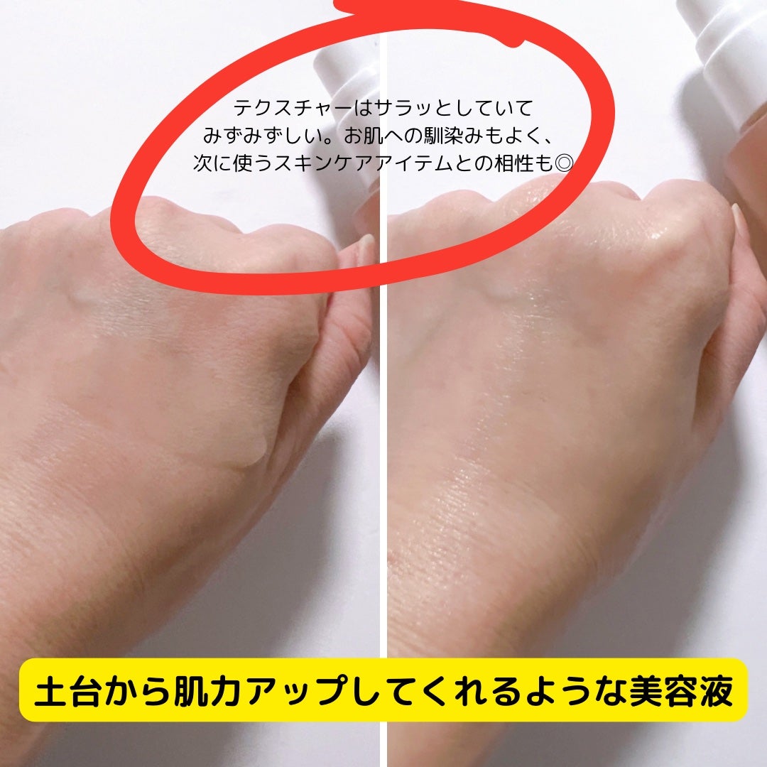 p/d 美容液/p/d/美容液を使ったクチコミ(4枚目)