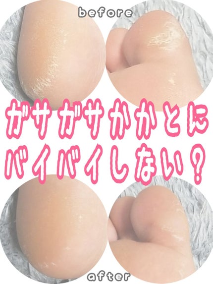 ベルベットスムーズ 電動角質リムーバー 海洋ミネラル/ドクター・ショール/レッグ・フットケアを使ったクチコミ(1枚目)