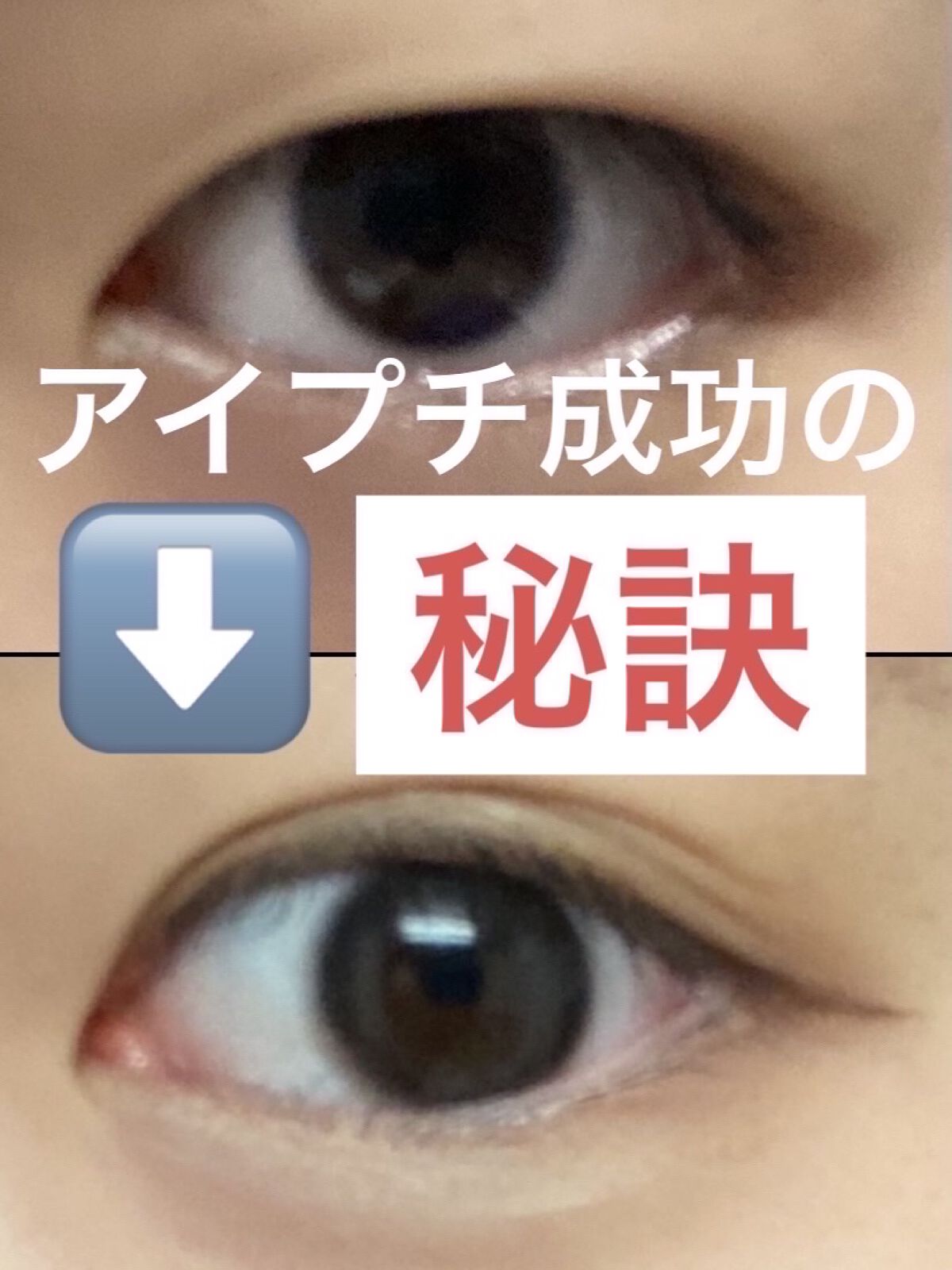 アイビューティー フィクサー WP/アストレア ヴィルゴ/二重まぶた用アイテムを使ったクチコミ（1枚目）