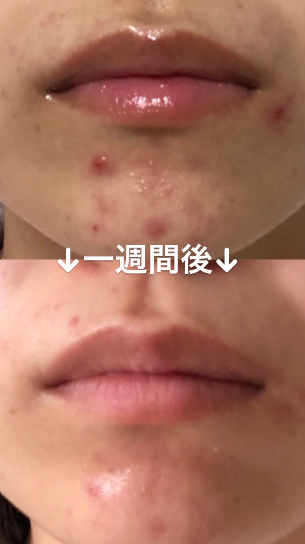 イハダ 薬用バーム【医薬部外品】/IHADA/フェイスバームを使ったクチコミ(2枚目)