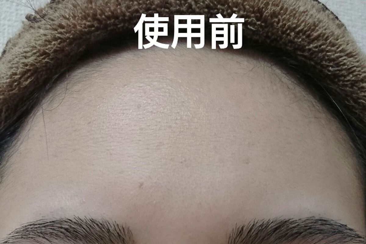 リアルティートリー シカ ウォッシュオフパック/ネイチャーリパブリック/洗い流すパック・マスクを使ったクチコミ(4枚目)