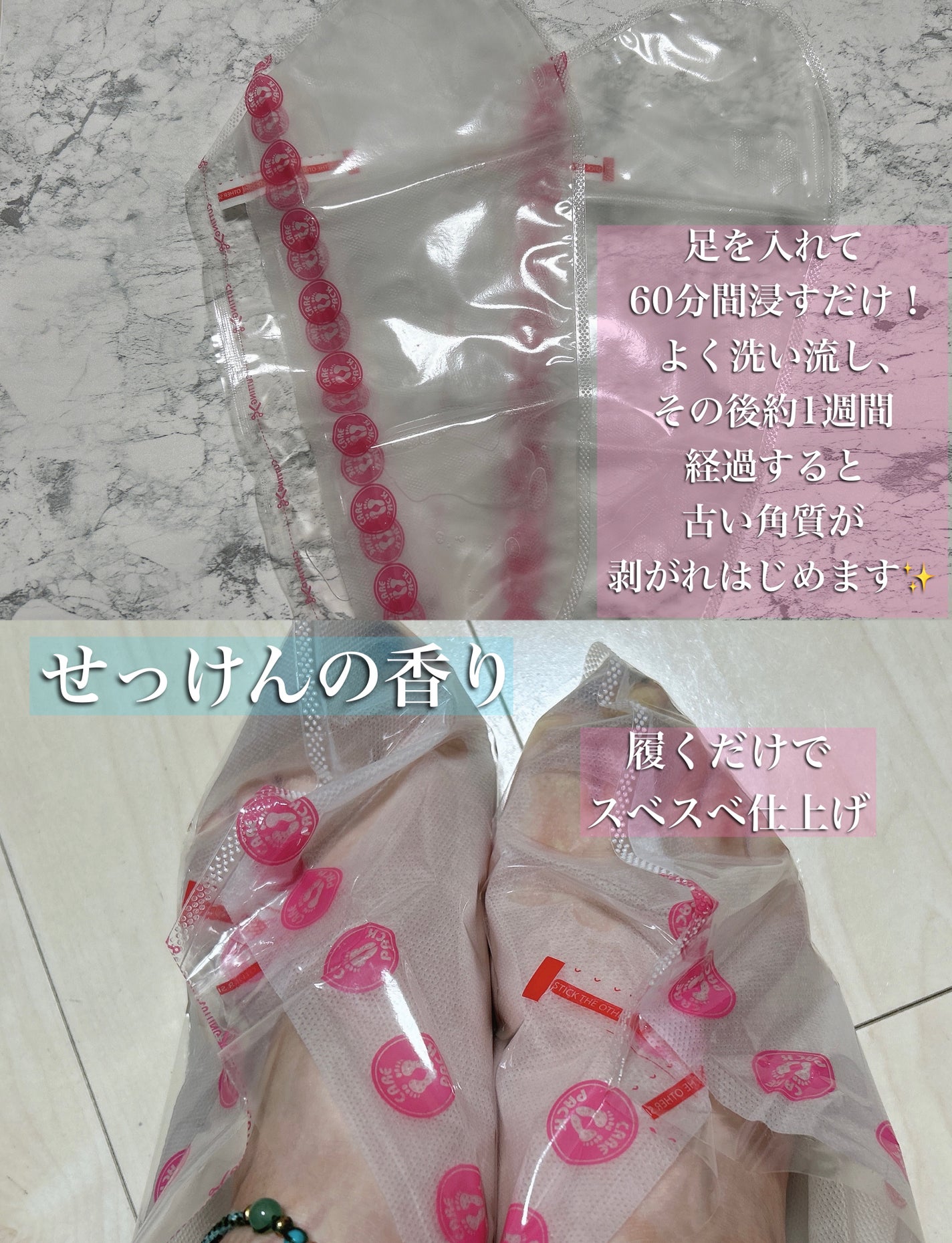 あしやすめ 足裏角質ケアパック/鎌倉ライフ/レッグ・フットケアを使ったクチコミ(2枚目)