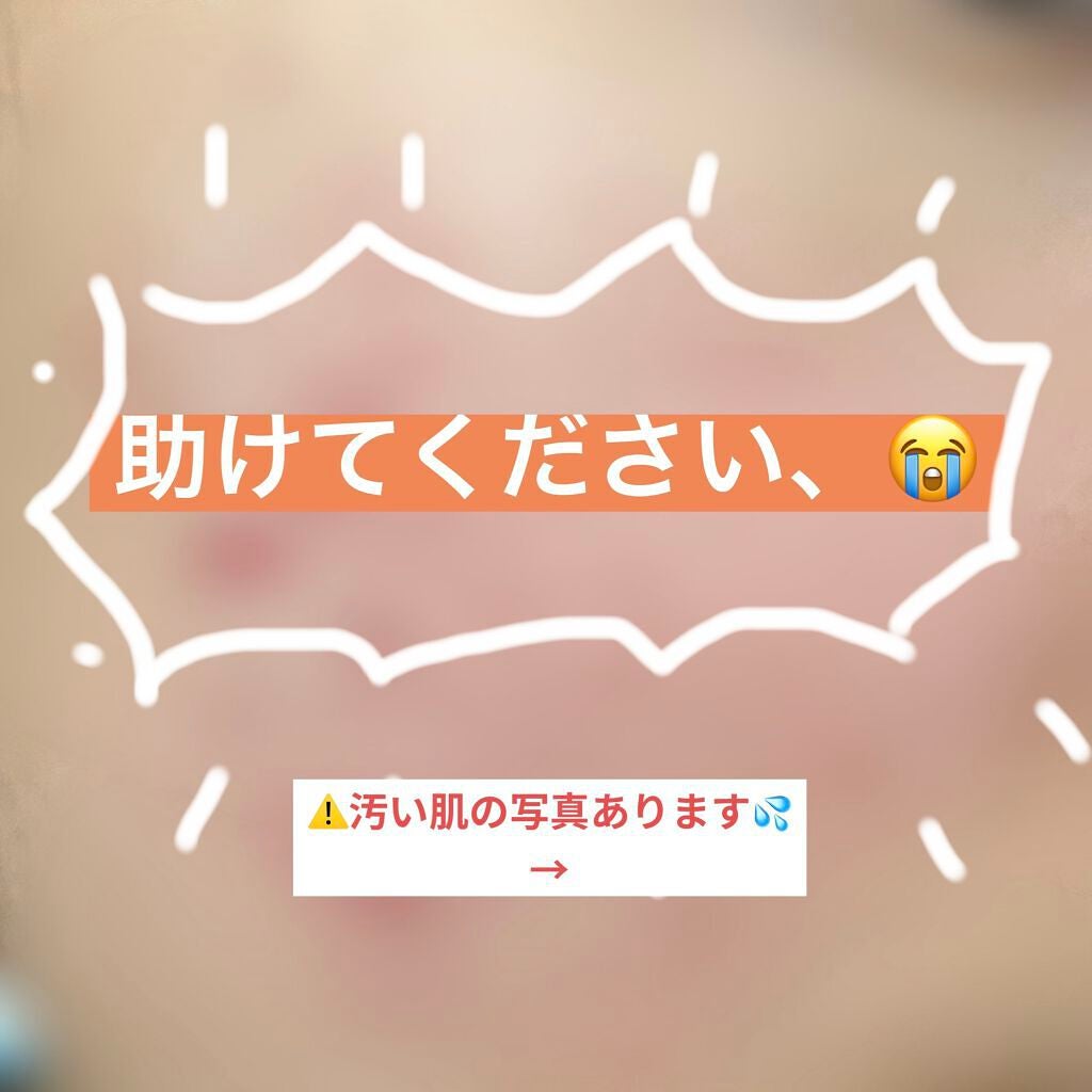 皮脂トラブルケア 化粧水/キュレル/化粧水を使ったクチコミ(1枚目)