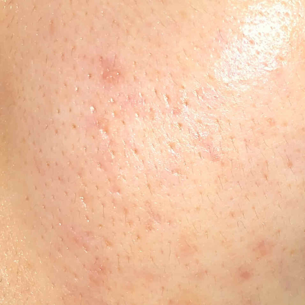 キールズ DS クリアリーブライト エッセンス[医薬部外品]/Kiehl's/美容液を使ったクチコミ（2枚目）