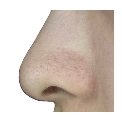 アンドハニー クレンジングバーム ブラック/&honey/クレンジングバームを使ったクチコミ(7枚目)