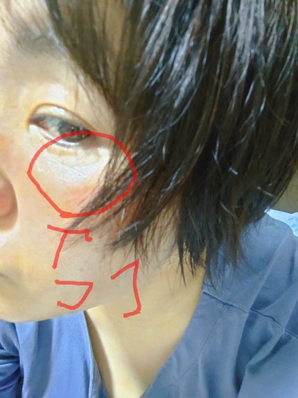 リンクルアイクリーム N/なめらか本舗/アイケア・アイクリームを使ったクチコミ(3枚目)