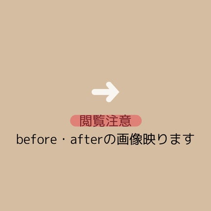 リップスリーピングマスク/LANEIGE/リップバームを使ったクチコミ(3枚目)