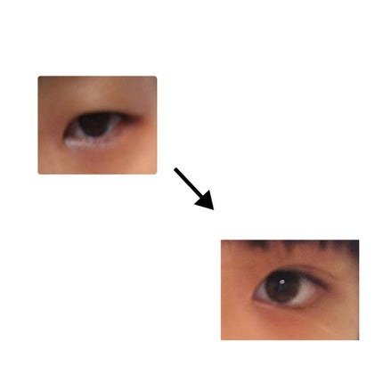 オロナインH軟膏 (医薬品)/オロナイン/その他を使ったクチコミ(3枚目)