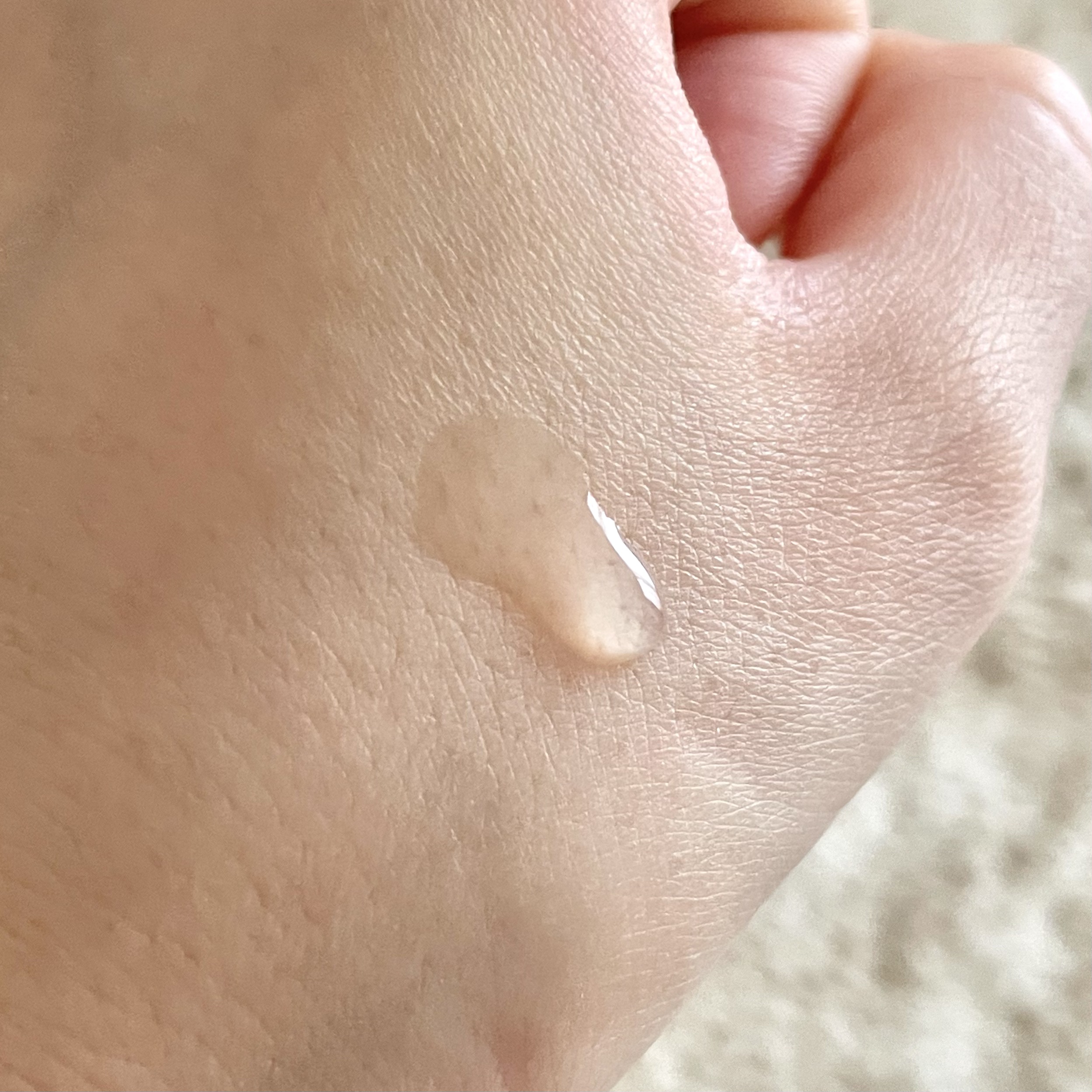 オイデルミン エッセンスローション/SHISEIDO/化粧水を使ったクチコミ（2枚目）