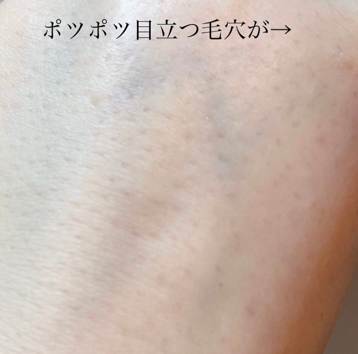 ポアレスフィクサー/プリマヴィスタ/ルースパウダーを使ったクチコミ(5枚目)