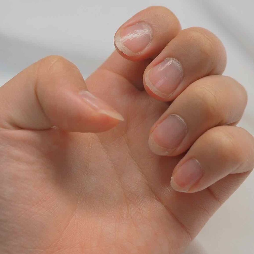 エテュセ クイックケアコート/ettusais/ネイルオイル・トリートメントを使ったクチコミ（2枚目）