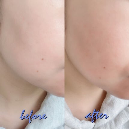 akopoko09 on LIPS 「🎼.•*¨*•.¸¸🎶ラグジュアリーな美容成分をたっぷりと配合..」(10枚目)