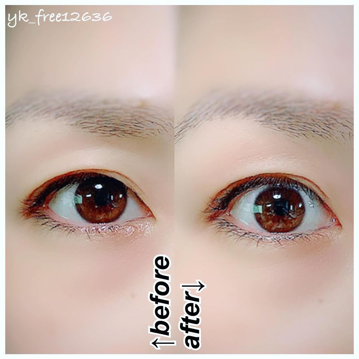 タフグルーX/フィクシー/二重まぶた用アイテムを使ったクチコミ(6枚目)