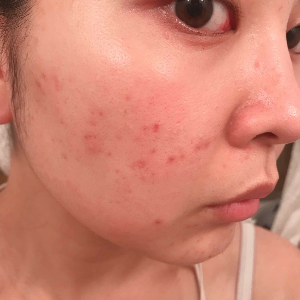 [I'm Sorry For My Skin] ポアケアジェリーマスク/ultru/シートマスク・パックを使ったクチコミ（3枚目）