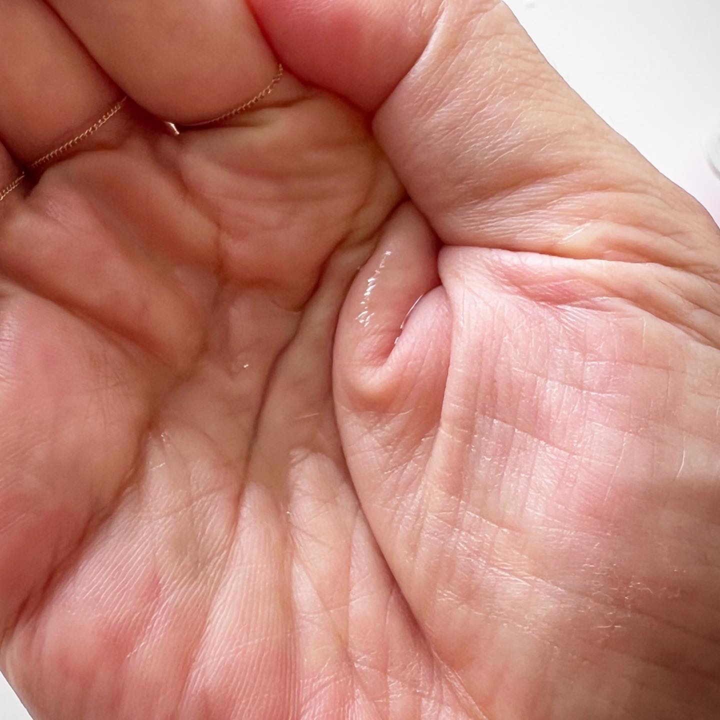 薬用アクアコラーゲンゲル スーパーセンシティブEX/ドクターシーラボⓇ/オールインワン化粧品を使ったクチコミ（2枚目）