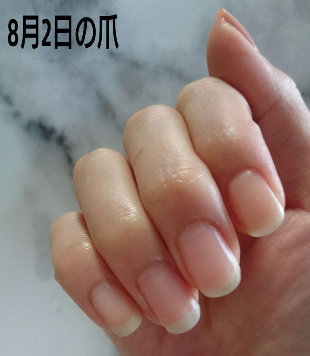 アンティセプト Lcnを使った口コミ ここ最近ネイルを施してくれる友人がスキルア By てまり 混合肌 40代前半 Lips
