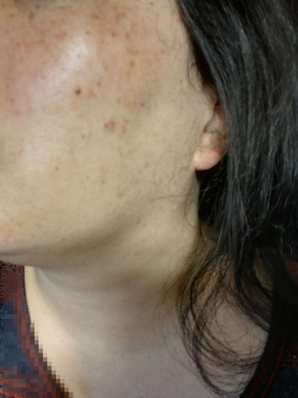 SKIN DISCOLORATION FADE CREAM/Nadinola/フェイスクリームを使ったクチコミ(3枚目)