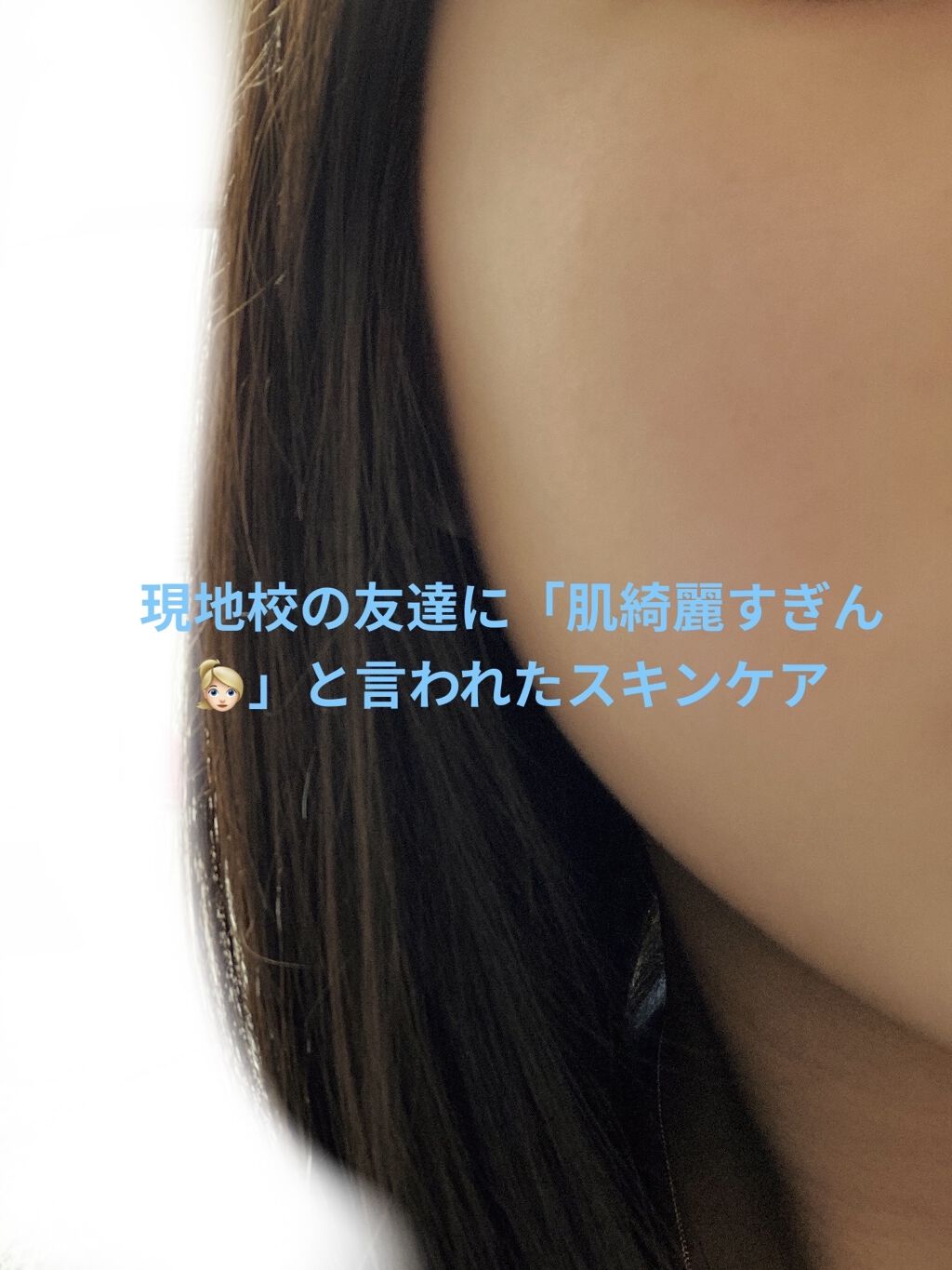 セタフィル モイスチャライジングローション/セタフィル/ボディローションを使ったクチコミ（1枚目）