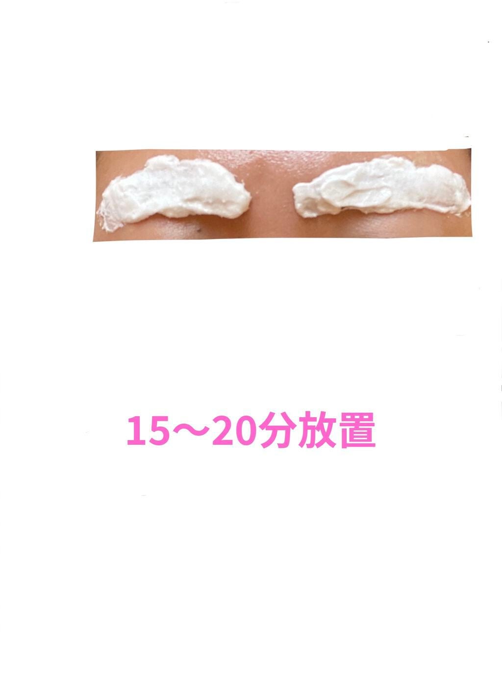 ジョレン クリーム ブリーチ/ジョレンジャパン/ムダ毛ケアを使ったクチコミ(6枚目)