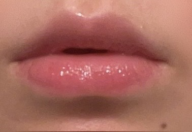 リードルS リッププランパービギナー/VT/リッププランパーを使ったクチコミ（2枚目）