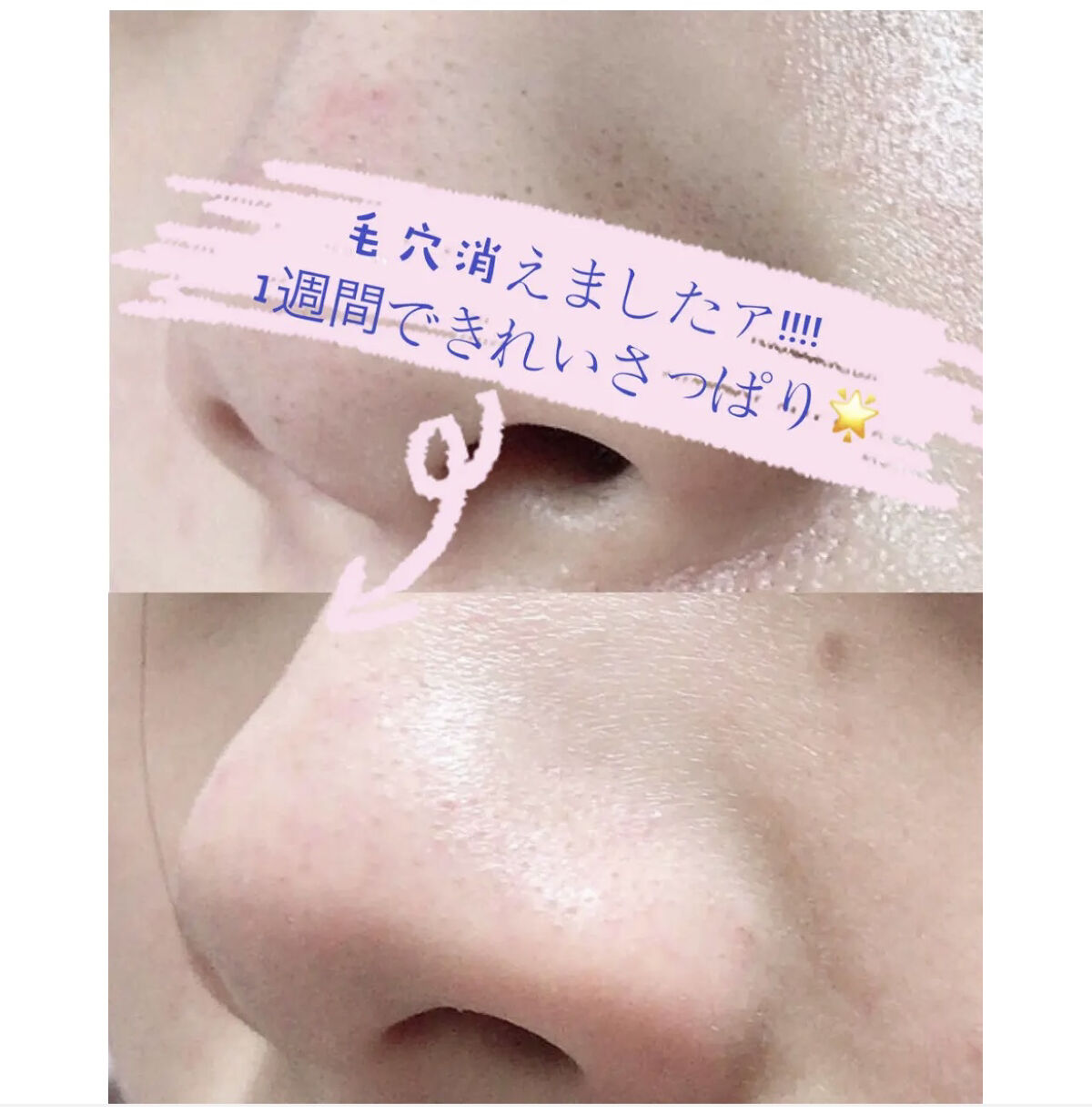 ホホバオイル 100ml/無印良品/ボディオイルを使ったクチコミ（1枚目）