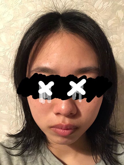 艶肌ドロップ/ラッシュ/美容液を使ったクチコミ(6枚目)