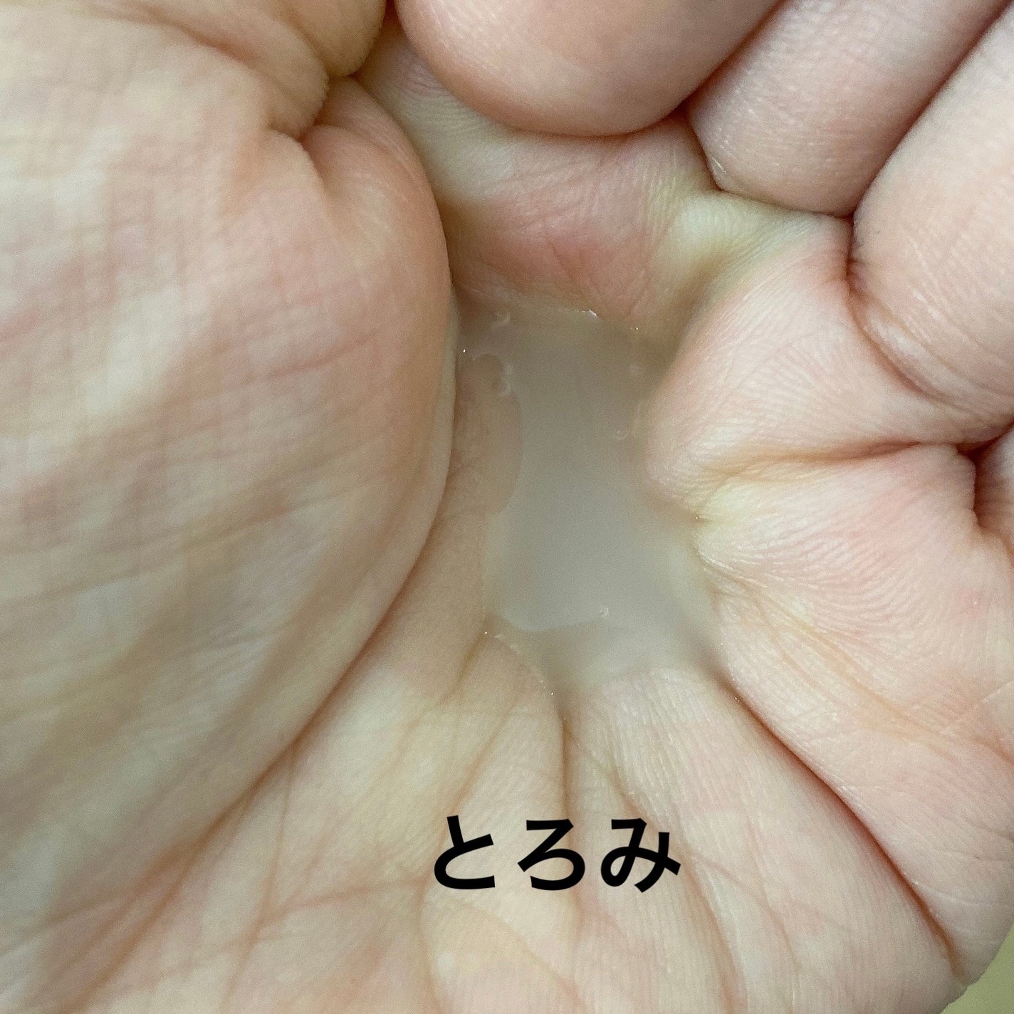 アルティミューン パワライジング コンセントレート Ⅲn/SHISEIDO/美容液を使ったクチコミ(3枚目)