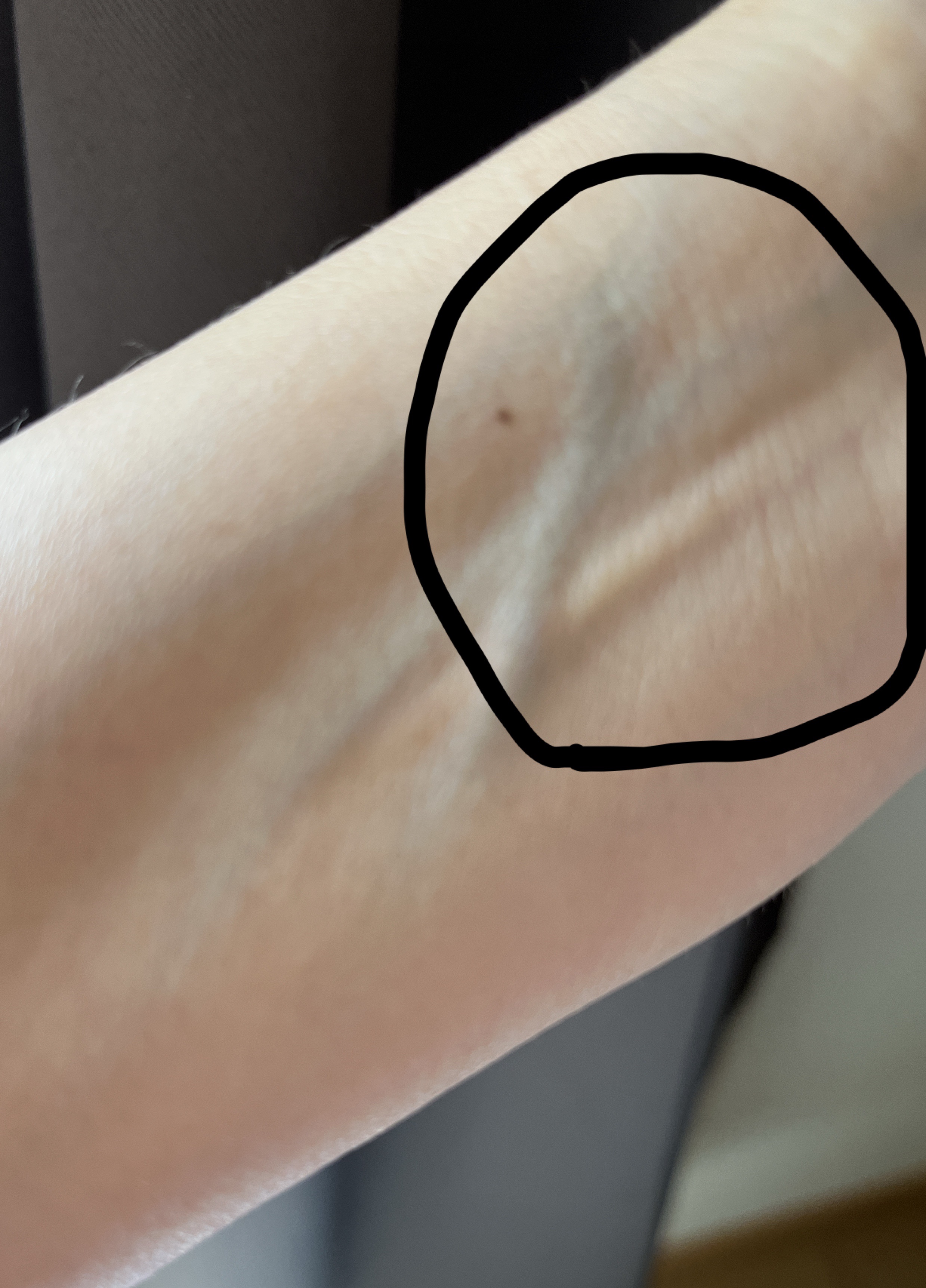 マシュマロフィニッシュパウダー　～Abloom～/キャンメイク/プレストパウダーを使ったクチコミ（2枚目）