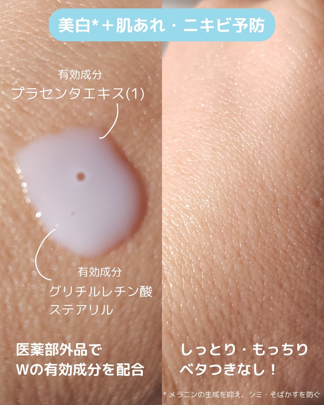 メゾン ド カーム ブライトニング ミストセラム/ナリスアップ/ボディローションを使ったクチコミ(3枚目)