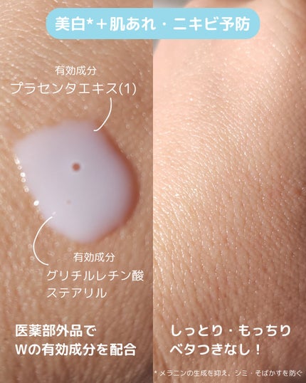 メゾン ド カーム ブライトニング ミストセラム/ナリスアップ/ボディローションを使ったクチコミ(3枚目)