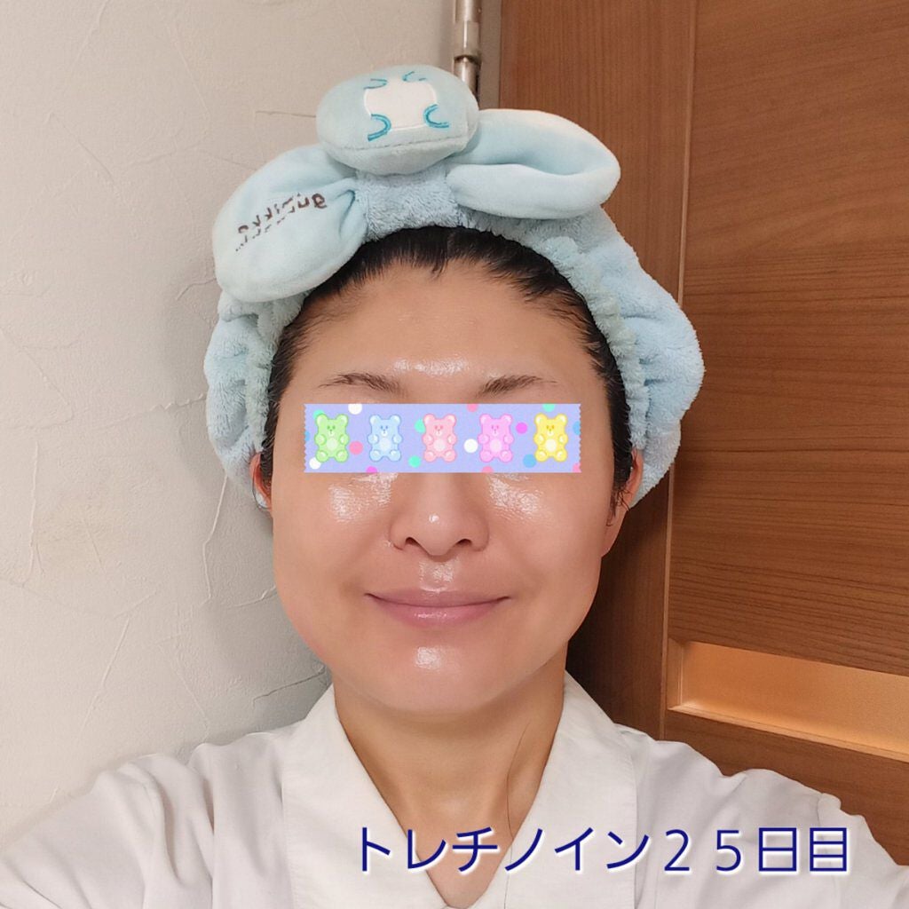 トレチノインジェル/A-Ret/美容液を使ったクチコミ(1枚目)