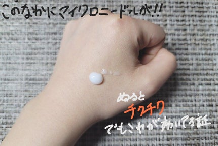 パーフェクトニードル/FABIUS/美容液を使ったクチコミ(3枚目)