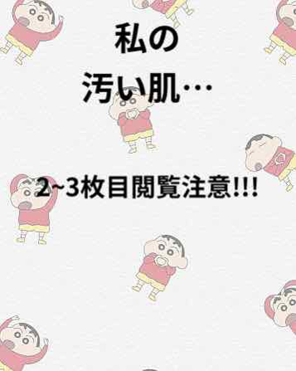 ハトムギ化粧水(ナチュリエ スキンコンディショナー R )/ナチュリエ/化粧水を使ったクチコミ（1枚目）