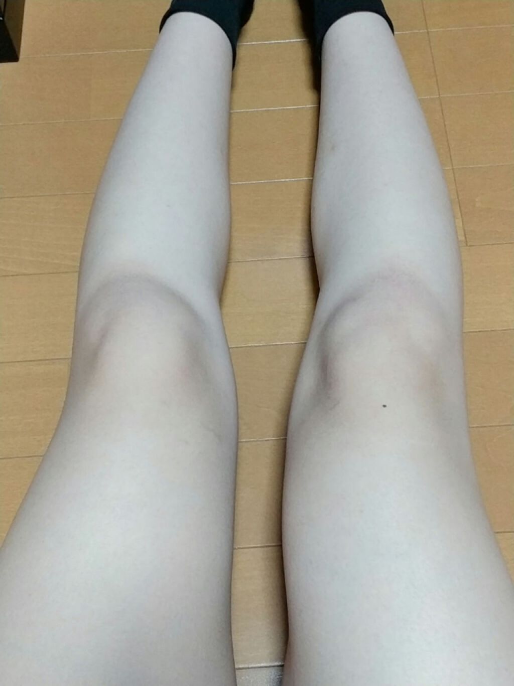 とろんと濃ジェル/なめらか本舗/オールインワン化粧品を使ったクチコミ（2枚目）