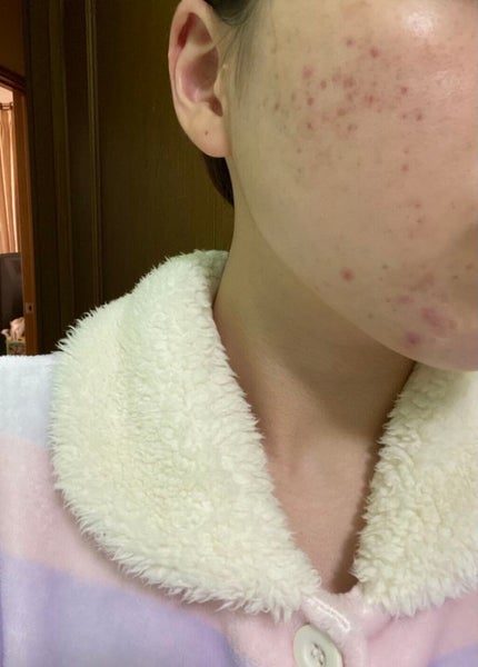 ハトムギ化粧水(ナチュリエ スキンコンディショナー R )/ナチュリエ/化粧水を使ったクチコミ(1枚目)