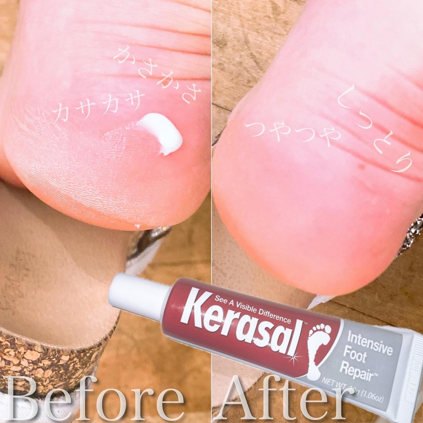 ケラサル ネイル爪栄養剤/Kerasal/ネイルオイル・トリートメントを使ったクチコミ(6枚目)