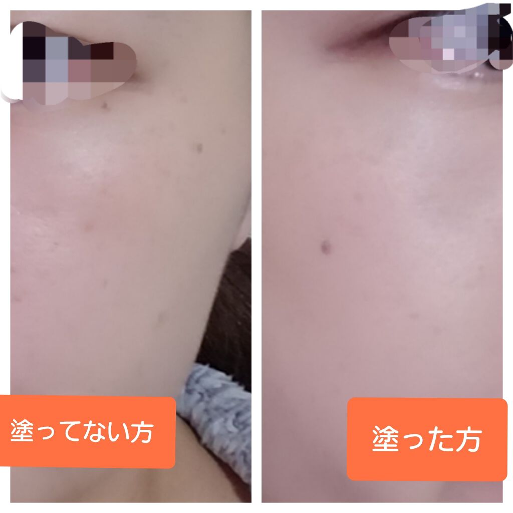 エバーグロウクッション SPF23 PA++/FEMMUE/クッションファンデーションを使ったクチコミ（2枚目）