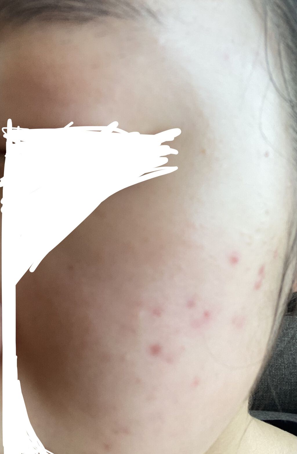 グリーン ダーマCICAビックトナー/ネイチャーリパブリック/化粧水を使ったクチコミ（3枚目）