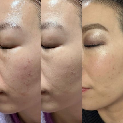 カラーステイ ロングウェア メイクアップ/REVLON/リキッドファンデーションを使ったクチコミ(3枚目)