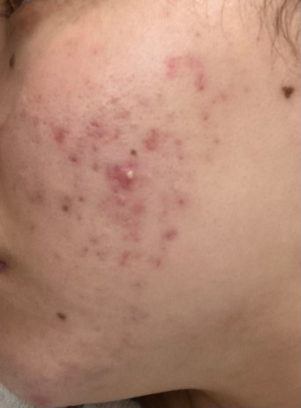 保湿クリーム /ちふれ/フェイスクリームを使ったクチコミ(1枚目)