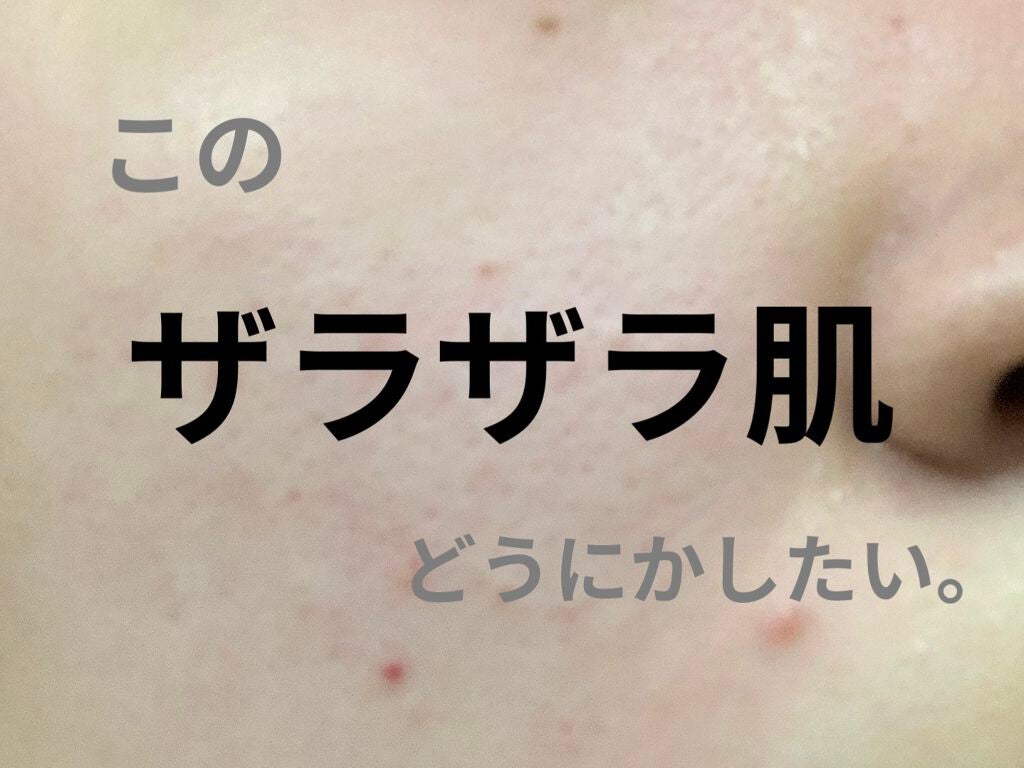 にこ on LIPS 「中学生時代から毛穴、ザラつき、ニキビ、ニキビ跡に悩んできました..」(1枚目)