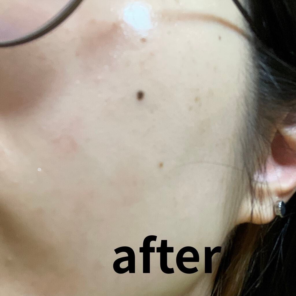 ユースキンシソラ ローション/ユースキン/ボディローションを使ったクチコミ(8枚目)