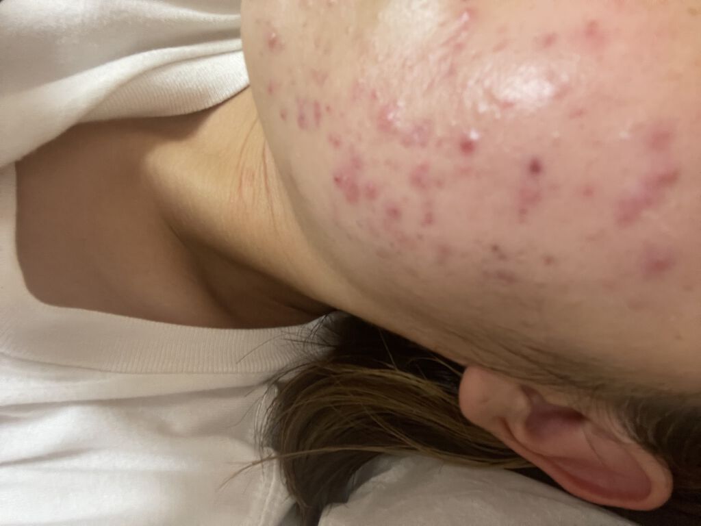 潤浸保湿 フェイスクリーム/キュレル/フェイスクリームを使ったクチコミ（1枚目）