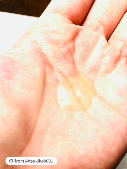 ビタペアC 集中美容液スペシャルセット/ネイチャーリパブリック/美容液を使ったクチコミ(5枚目)