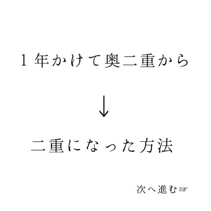 アイトーク/アイトーク/二重まぶた用アイテムを使ったクチコミ(1枚目)