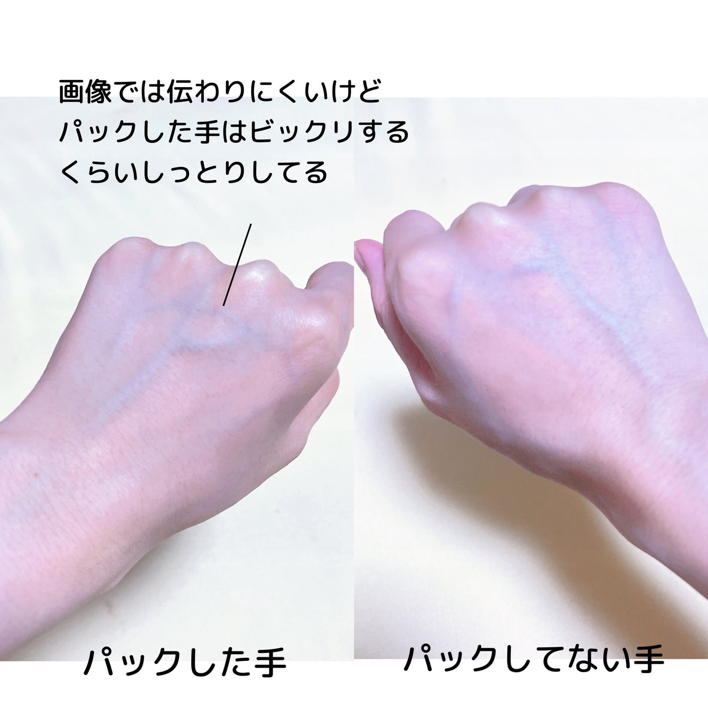 ドクダミ化粧水/ONE THING/化粧水を使ったクチコミ(5枚目)