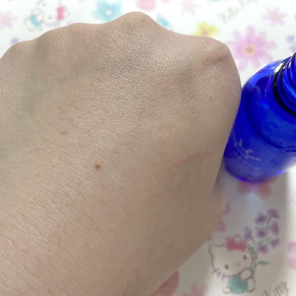 薬用アクレケア/総健美舎/美容液を使ったクチコミ(4枚目)