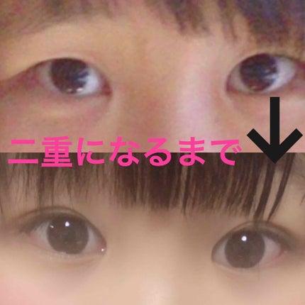 アイトーク/アイトーク/二重まぶた用アイテムを使ったクチコミ(1枚目)