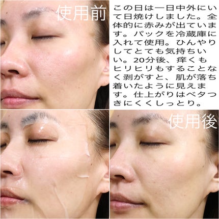 レッドブレミッシュ クールスージングマスク/Dr.G/シートマスク・パックを使ったクチコミ(4枚目)