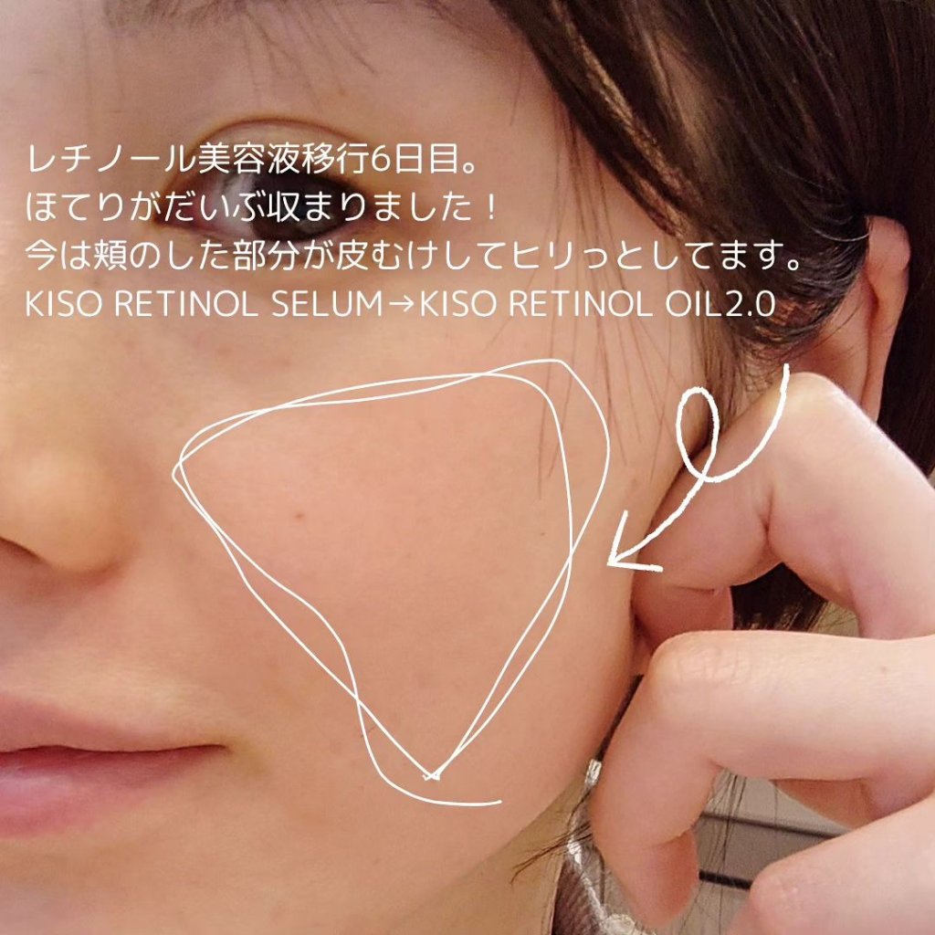 オイルセラムRE2/KISO/美容液を使ったクチコミ（2枚目）
